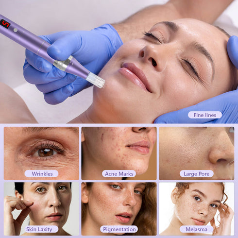 QUELLE Adjustable Dial PROFESSIONAL MICRONEEDLING PEN KIT